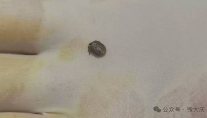 近期高发!黑龙江一医院接诊近20例!紧急提醒!